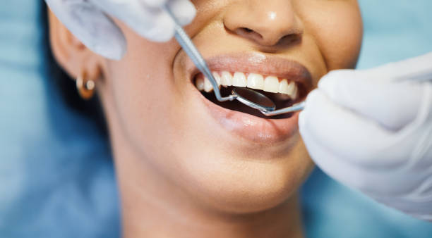 Best Dental Abscess Treatment in Marion, IN